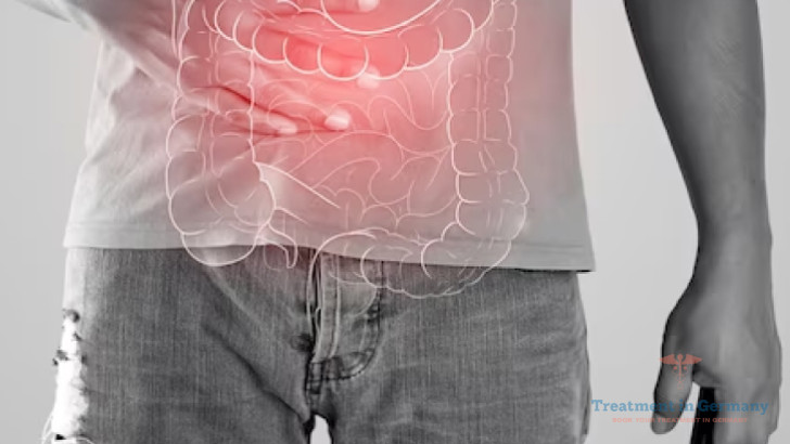 Peritoneal Cancer Treatment in Germany