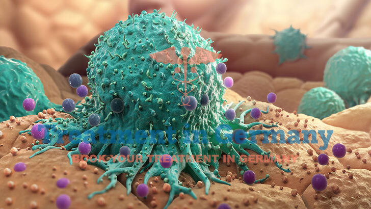 Cancer Treatment in Germany