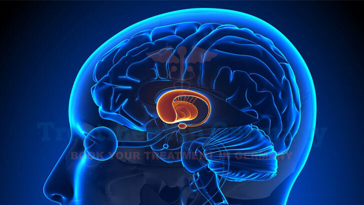 Parkinson’s disease Treatment in Germany