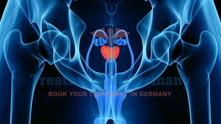 Advanced Prostate Cancer Treatment in Germany