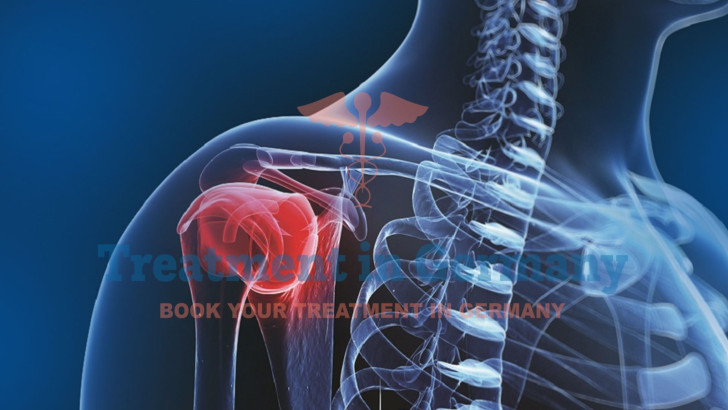 New Immunotherapy for Osteosarcoma: Treatment with Dendritic Cell Therapy