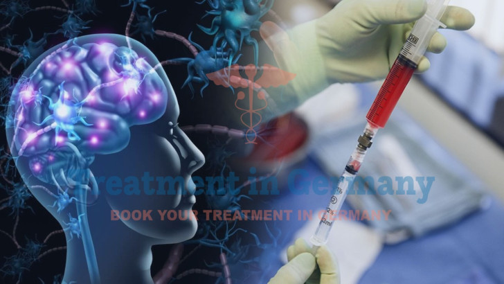 Stem Cell Therapy for Autism in Germany