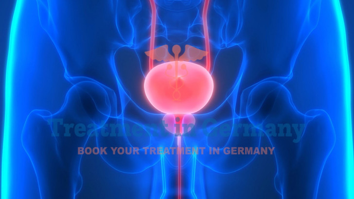 The German Protocol for Bladder Cancer Treatment Using Dendritic Cell Therapy
