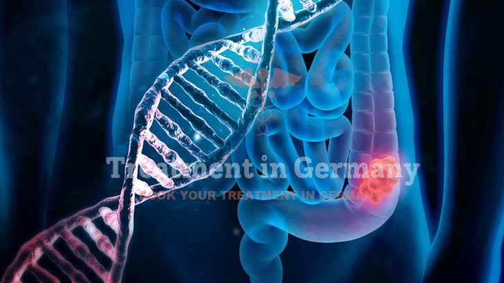 Colon cancer treatment with dendritic cells in Germany