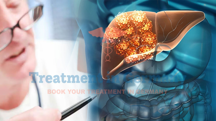 Dendritic Cell Therapy for Sarcoma with Liver Metastasis in Germany