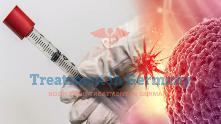 How TACE Therapy Is Used for Cancer Treatment in Germany