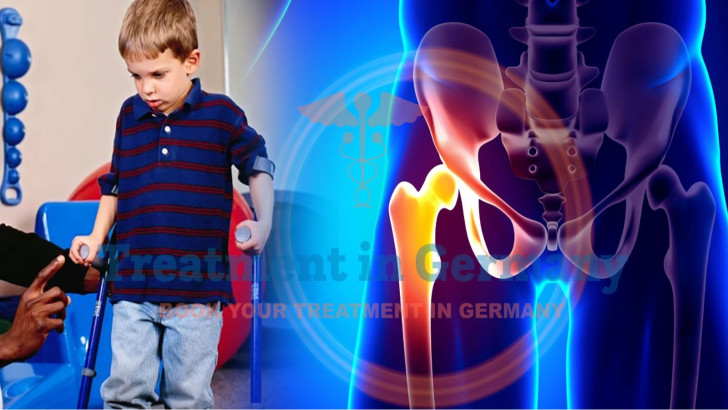 Perthes Disease Treatment in Germany
