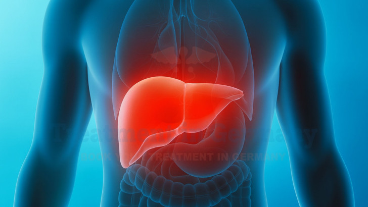 Innovative Solutions for the Treatment of Liver Cancer and Liver Metastases in Germany