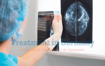 Mammographic Abnormalities Treatment in Germany