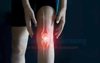 Osteochondritis Dissecans Treatment in Germany