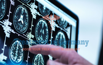 Latest Epilepsy Research from German Centers