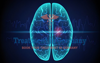 Exploring Alternative Epilepsy Treatments in Germany