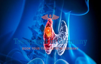 Innovative Methods of Thyroid Cancer Treatment in Germany