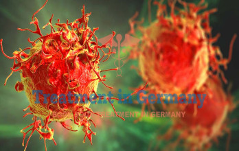 Dendritic Cell Therapy for Melanoma: German Treatment Options