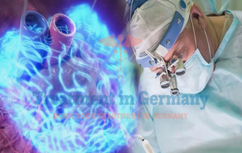 NanoKnife Prostate Cancer Treatment in Germany