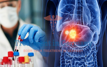 Germany’s Approach to Treating Advanced Liver Cancer with Immunotherapy