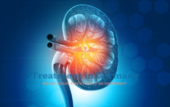 Klatskin Tumor: Advanced Bile Duct Cancer Treatment in Germany