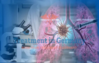 New Effective Treatments for Stage 4 Lung Cancer 2025