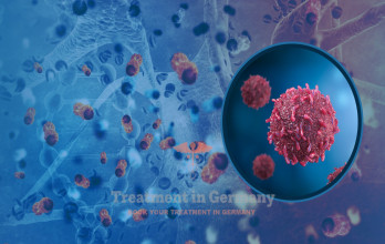 Second Opinion in Germany: When to Consider Dendritic Cell Therapy for Cancer
