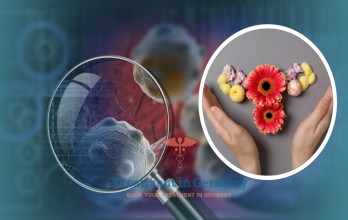 Endometrial Cancer Treatment in Germany