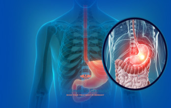 Advanced Stomach Cancer Treatment Options in Germany