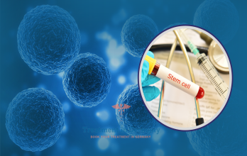 Types of Stem Cell Treatments Available in Germany