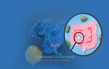 Advanced Colon cancer treatment with dendritic cells in Germany