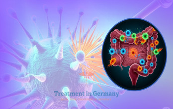 Why Colon Cancer Patients Are Choosing Germany for Immunotherapy
