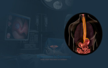 Esophageal Cancer Treatment Options in Germany