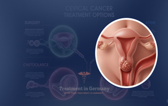 Cervical Cancer Treatment Options in Germany for Australian Patients