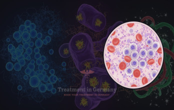 Acute Lymphoblastic Leukemia Treatment Options in Germany for USA Patients