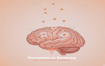 Stem Cell Therapy for Dementia in Germany for International Patients