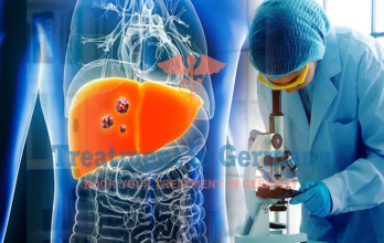 Dendritic Cell Therapy for Melanoma with Liver Metastasis in Germany