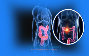 Dendritic Cell Therapy for Colon and Colorectal Cancer in Germany
