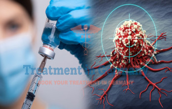How Dendritic Cell Therapy Is Used for Cancer Treatment in Germany