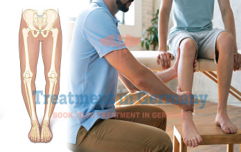 Genu Varum (Bowed Legs) Treatment in Germany