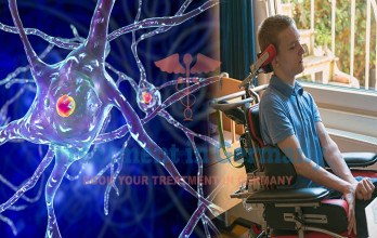 Motor Neurone Disease Treatment in Germany
