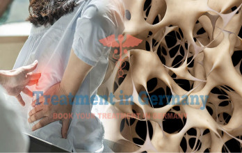 Osteoporosis Treatment in Germany