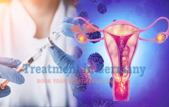 Immunotherapy with Dendritic Cells for Uterine Cancer in Germany