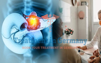 Optimizing Nutritional Support for Stage 4 Pancreatic Cancer: Germany’s Approach to Cancer Care