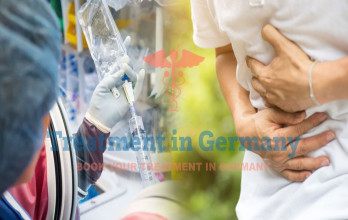 Latest Immunotherapy Options for Colon Cancer Patients in Germany