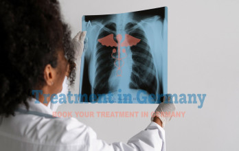 How Doctors Treat the Most Common Type of Lung Cancer in Germany