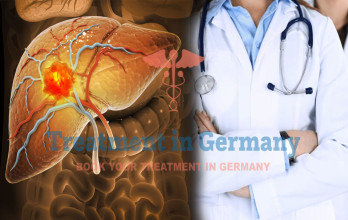 Treatment Options in Germany When Liver Cancer Has Spread