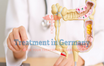 Treatment of stage 4 Colorectal cancer in Germany