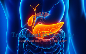 Bile Duct Cancer treatment in Germany