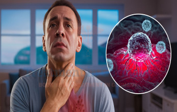 Stage 4 Esophageal Cancer Symptoms