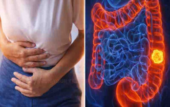 Small Bowel Cancer: All Treatment Options for Small Intestine Cancer
